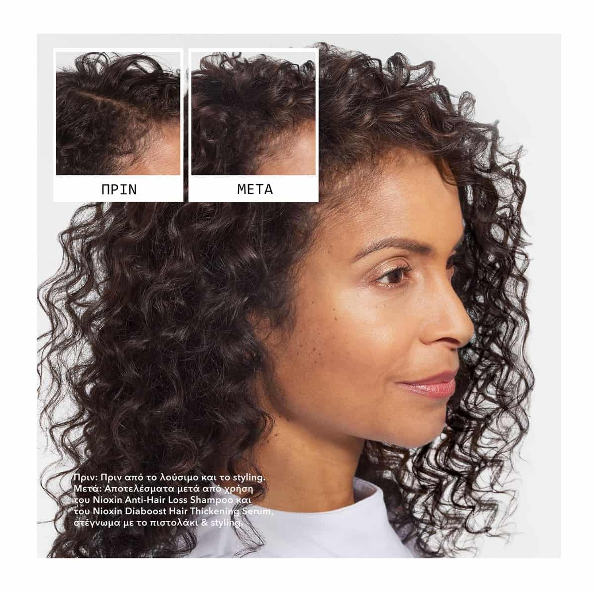 Nioxin Anti-Hair Loss Σαμπουάν κατά της Τριχόπτωσης 240ml